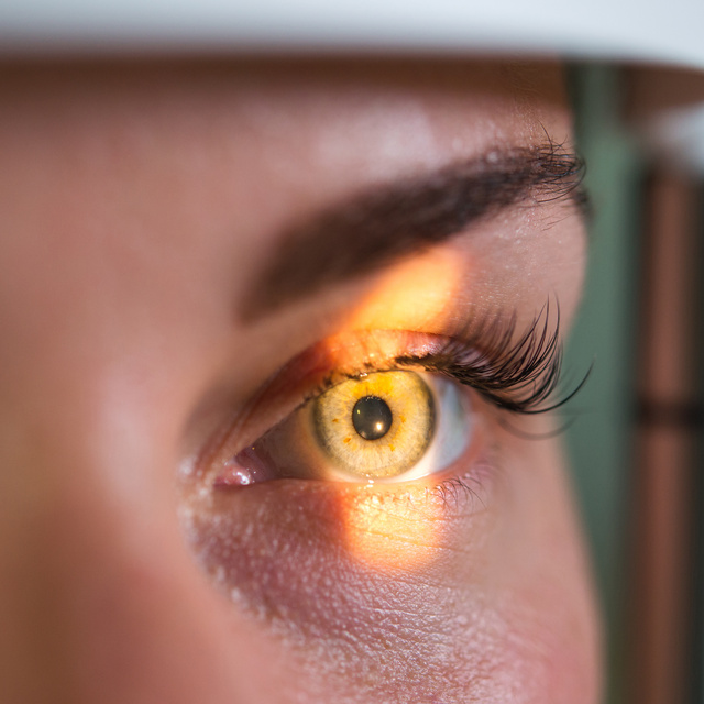 Vision Therapy in Palatine